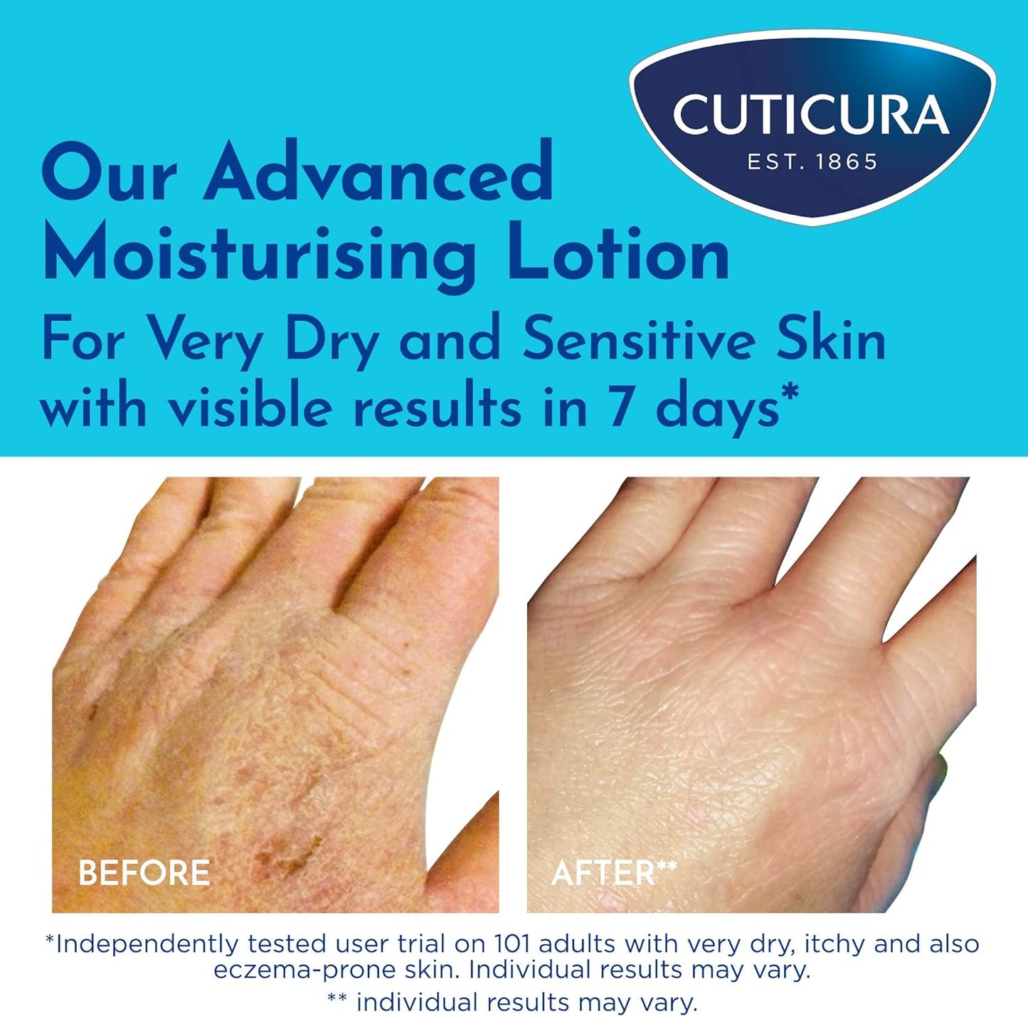 Cuticura Mildly Medicated Dry Skin Cream 200mL