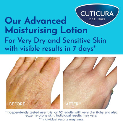 Cuticura Mildly Medicated Dry Skin Cream 200mL